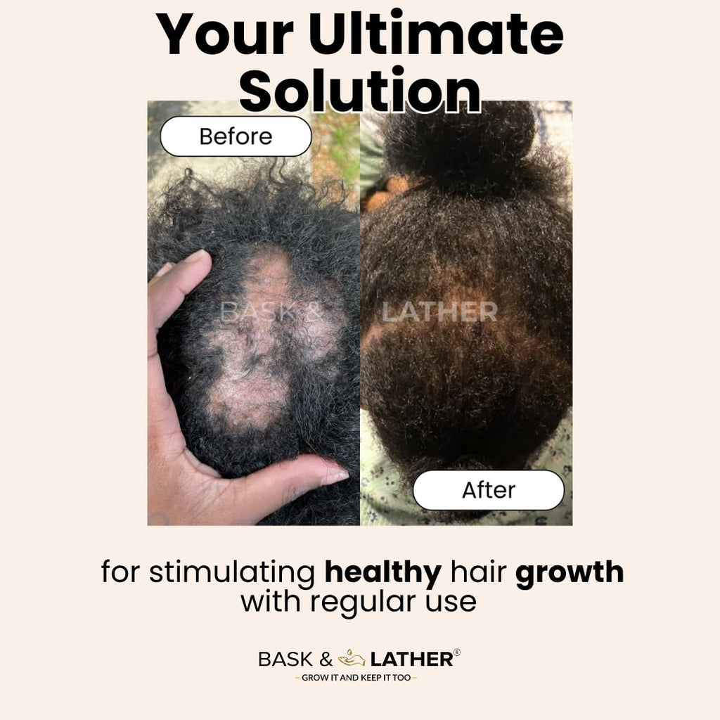 Grow Mode - Scalp & Hair Oil 