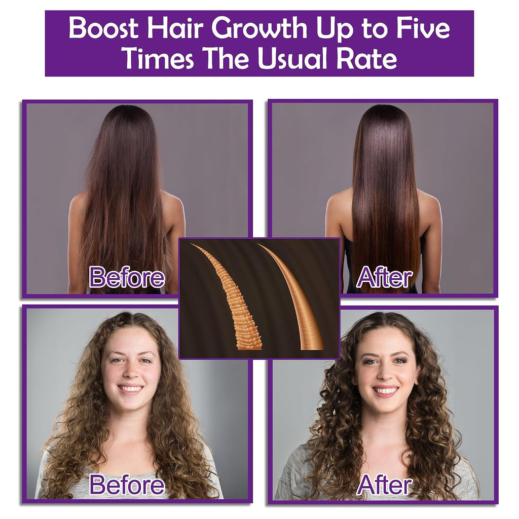 Rosemary + Biotin 3 Piece Hair Care Set l Shampoo, Conditioner & Serum 