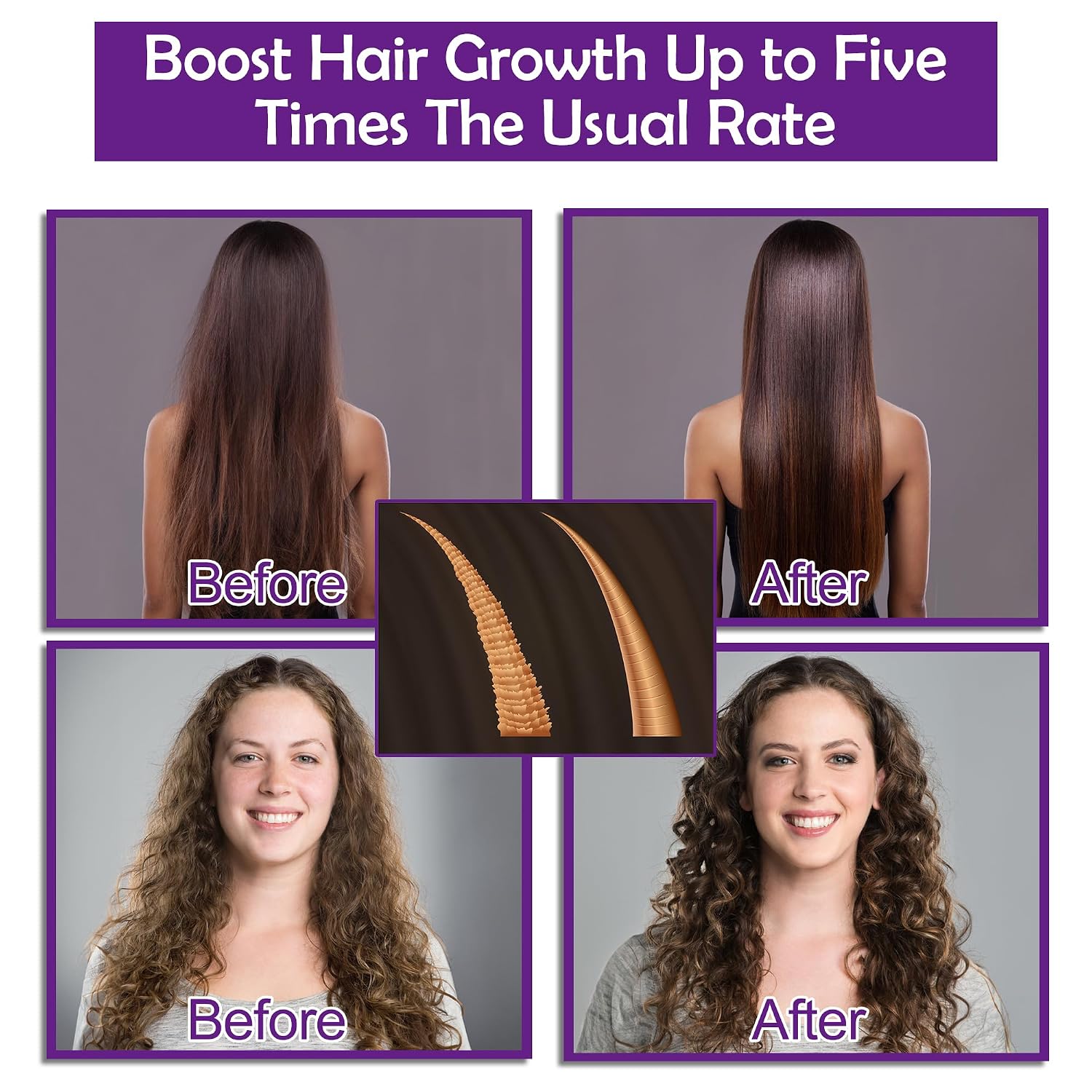Rosemary + Biotin 3 Piece Hair Care Set l Shampoo, Conditioner & Serum 